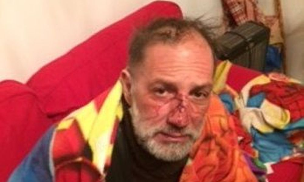 Ξανά στο στόχαστρο οι φωτορεπόρτερ από μαυροντυμένους και ΜΑΤ