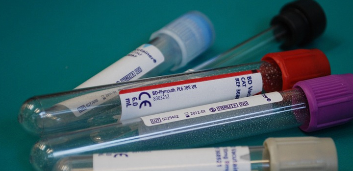 Στελέχωση του Αιματολογικού Εργαστηρίου του Γενικού Νοσοκομείου Κοζάνης «Μαμάτσειο» με δύο επικουρικούς ιατρούς.